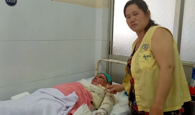 Bà chủ quán nhậu bị tạt axit tử vong - 1 Bà chủ quán nhậu bị tạt axit tử vong - 1
