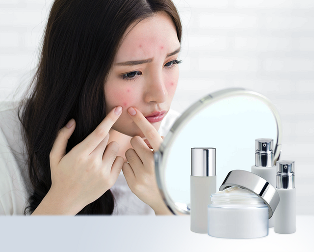 O2 SKIN - 3 yếu tố làm nên câu chuyện thương hiệu chuyên trị mụn - 1 O2 SKIN - 3 yếu tố làm nên câu chuyện thương hiệu chuyên trị mụn - 1