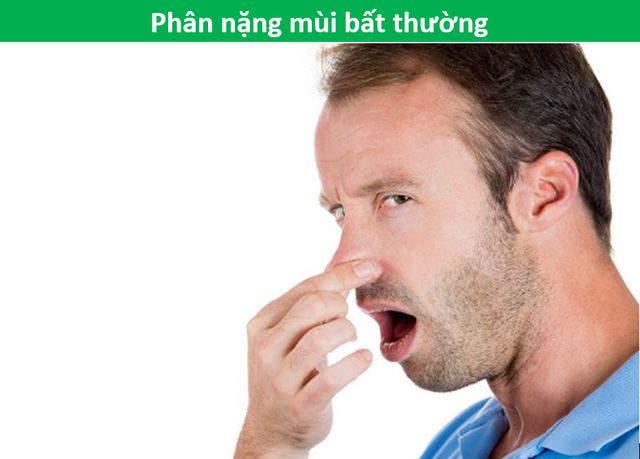 Cảnh giác với ung thư đại trực tràng nếu có nhiều hơn 3/5 dấu hiệu này - 6 Cảnh giác với ung thư đại trực tràng nếu có nhiều hơn 3/5 dấu hiệu này - 6