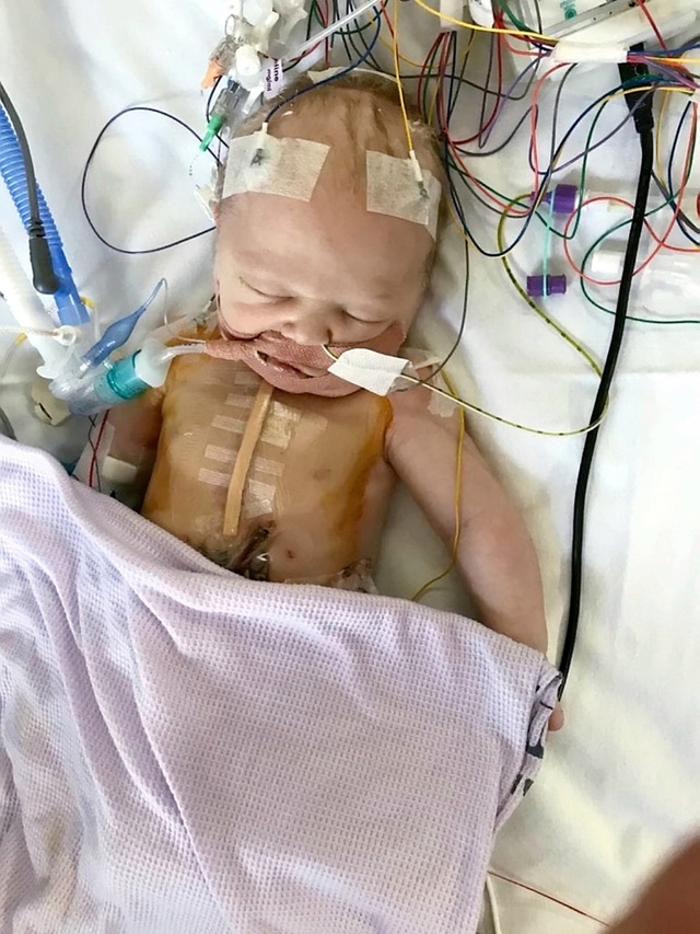 Cứu sống bé bị 3 dị tật tim khi mới sinh được 18 tiếng - 1
