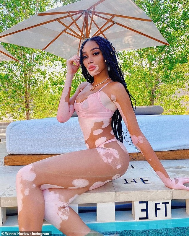 Winnie Harlow diện áo tắm bốc lửa - 1 Winnie Harlow diện áo tắm bốc lửa - 1