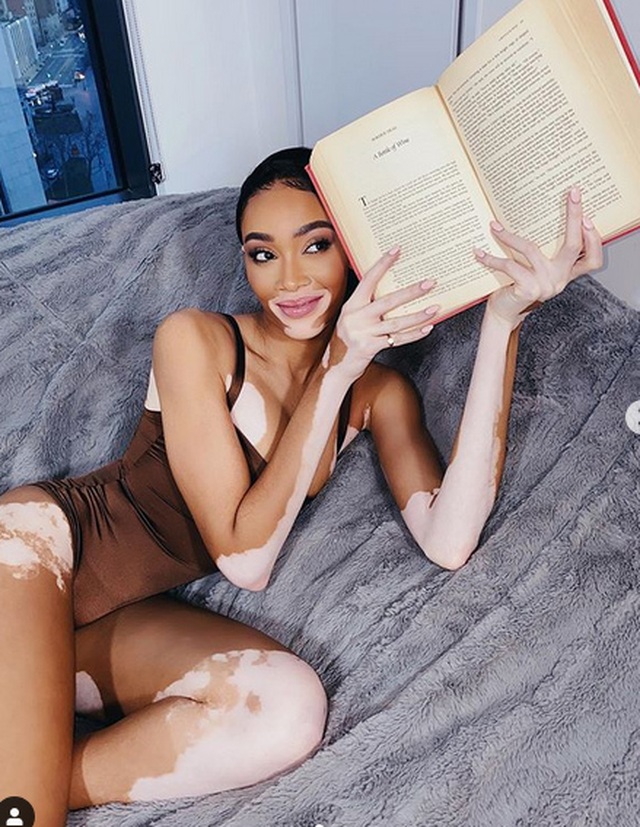Winnie Harlow diện áo tắm bốc lửa - 3 Winnie Harlow diện áo tắm bốc lửa - 3