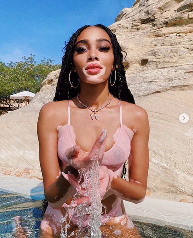 Winnie Harlow diện áo tắm bốc lửa - 5 Winnie Harlow diện áo tắm bốc lửa - 5
