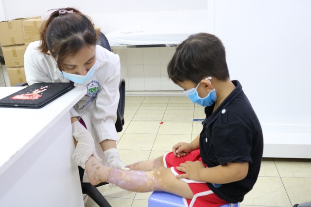 Bạch biến da, nỗi ám ảnh trên cơ thể người bệnh - 2 Bạch biến da, nỗi ám ảnh trên cơ thể người bệnh - 2