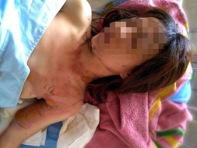 Thực hư chuyện cô gái đi giữa đường bất ngờ bị tạt xăng - 1 Thực hư chuyện cô gái đi giữa đường bất ngờ bị tạt xăng - 1