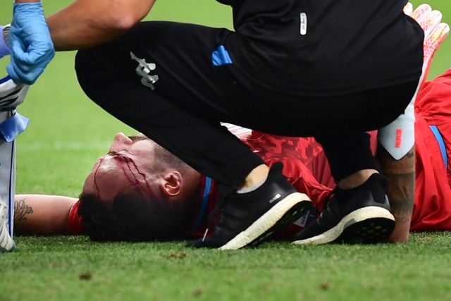 Cựu thủ môn Arsenal gặp chấn thương kinh hoàng sau nỗ lực cản phá bóng - 2 Cựu thủ môn Arsenal gặp chấn thương kinh hoàng sau nỗ lực cản phá bóng - 2