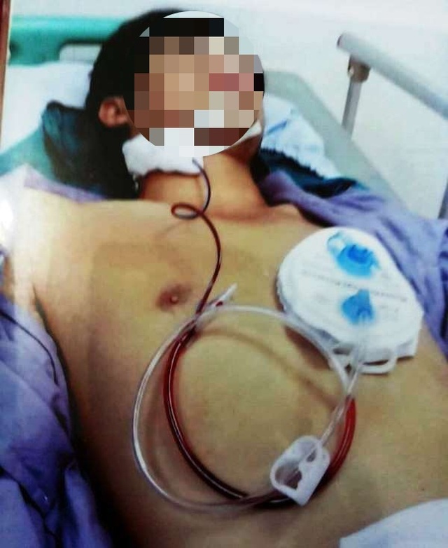 Bị can ngăn, Đường “Nhuệ” đánh nam thanh niên gãy xương hàm dưới - 2 Bị can ngăn, Đường “Nhuệ” đánh nam thanh niên gãy xương hàm dưới - 2