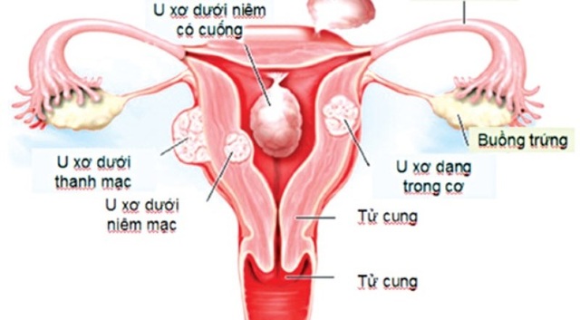 Để vô sinh, hiếm muộn điều trị có hiệu quả! - 1 Để vô sinh, hiếm muộn điều trị có hiệu quả! - 1