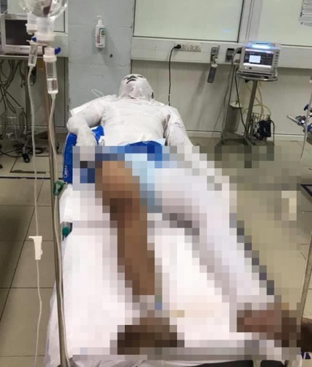 Nghi bị mách lẻo nên mất việc, tạt xăng rồi thiêu đốt con nợ - 1 Nghi bị mách lẻo nên mất việc, tạt xăng rồi thiêu đốt con nợ - 1