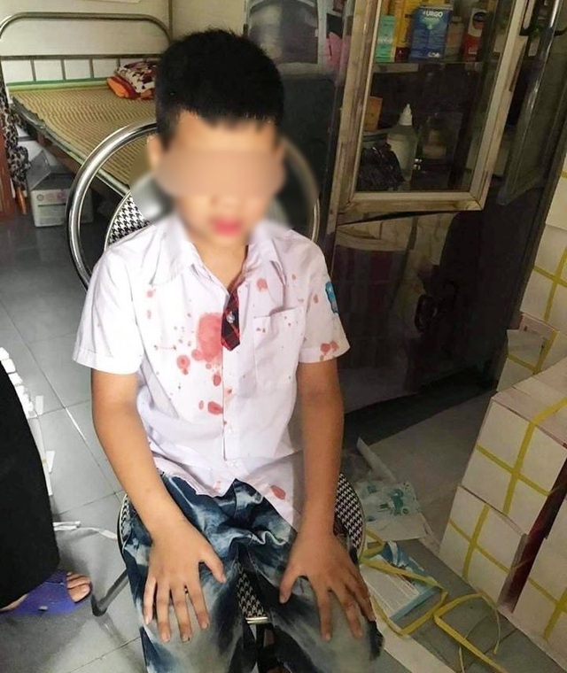 Phụ huynh vào trường đánh bé trai lớp 1 để... giải quyết mâu thuẫn cho con - 1 Phụ huynh vào trường đánh bé trai lớp 1 để... giải quyết mâu thuẫn cho con - 1