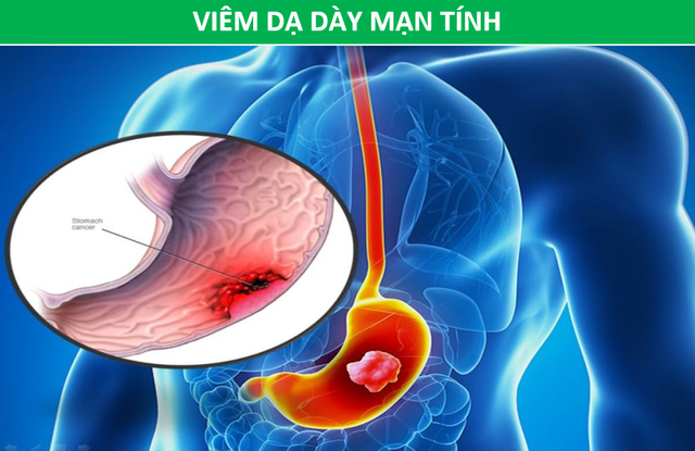 Cảnh giác với nhiều bệnh nguy hiểm khi mắt xuất hiện quầng thâm - 3 Cảnh giác với nhiều bệnh nguy hiểm khi mắt xuất hiện quầng thâm - 3
