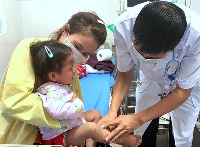 Hơn 10.000 trẻ mắc tay chân miệng, Bộ Y tế gửi công văn khẩn - 1