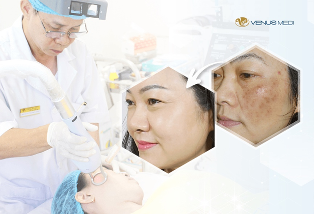 Tiết lộ lý do Thẩm mỹ viện Shark Hưng đầu tư nhận thêm 1 triệu đô từ đối tác quốc tế - 1 Tiết lộ lý do Thẩm mỹ viện Shark Hưng đầu tư nhận thêm 1 triệu đô từ đối tác quốc tế - 1