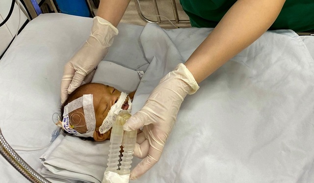 Bé trai sơ sinh bị bỏ rơi hôn mê trước cổng chùa - 1 Bé trai sơ sinh bị bỏ rơi hôn mê trước cổng chùa - 1