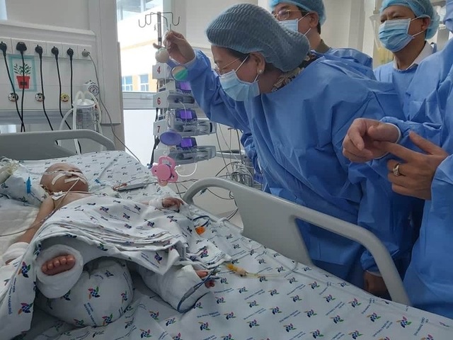 Một bé trong cặp song sinh sau tách dính đã cai được máy thở - 1