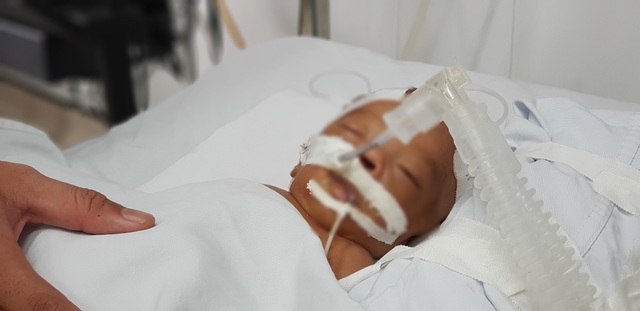 Bé trai bị bỏ rơi trước cổng chùa đang viêm phổi, nhiễm trùng huyết - 1 Bé trai bị bỏ rơi trước cổng chùa đang viêm phổi, nhiễm trùng huyết - 1