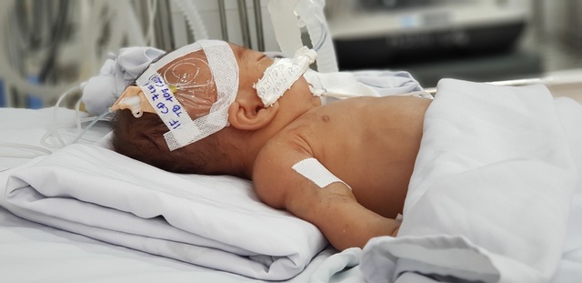 Bé trai bị bỏ rơi trước cổng chùa đang viêm phổi, nhiễm trùng huyết - 2 Bé trai bị bỏ rơi trước cổng chùa đang viêm phổi, nhiễm trùng huyết - 2