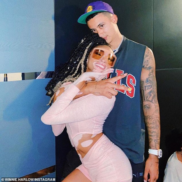 Winnie Harlow ngọt ngào chúc mừng sinh nhật bạn trai mới - 2 Winnie Harlow ngọt ngào chúc mừng sinh nhật bạn trai mới - 2