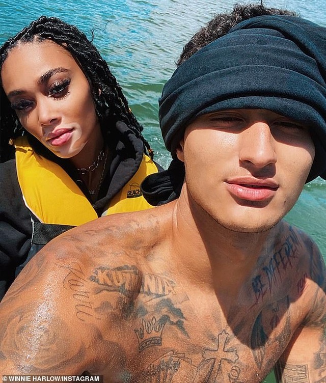 Winnie Harlow ngọt ngào chúc mừng sinh nhật bạn trai mới - 3 Winnie Harlow ngọt ngào chúc mừng sinh nhật bạn trai mới - 3