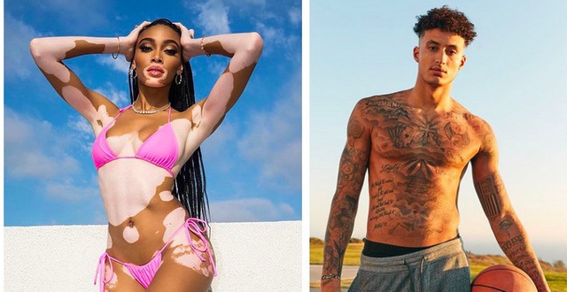 Winnie Harlow ngọt ngào chúc mừng sinh nhật bạn trai mới - 7 Winnie Harlow ngọt ngào chúc mừng sinh nhật bạn trai mới - 7