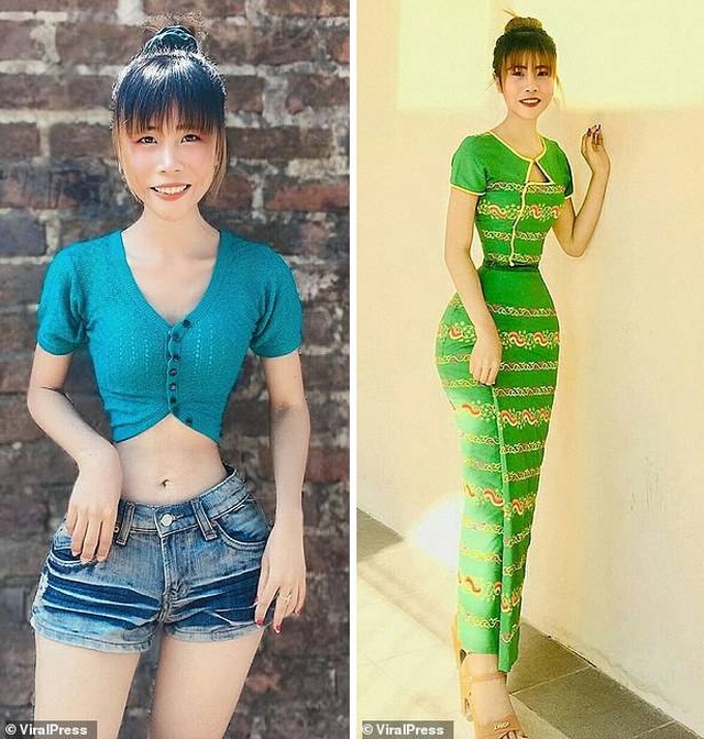 Cô gái Myanmar sở hữu “vòng eo con kiến” 35 cm - 2 Cô gái Myanmar sở hữu “vòng eo con kiến” 35 cm - 2