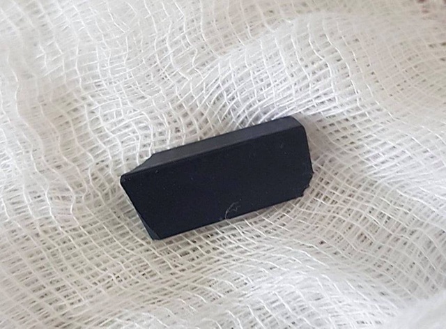 Cháu bé 3 tuổi nuốt nút điều khiển tivi vào khí quản - 2 Cháu bé 3 tuổi nuốt nút điều khiển tivi vào khí quản - 2