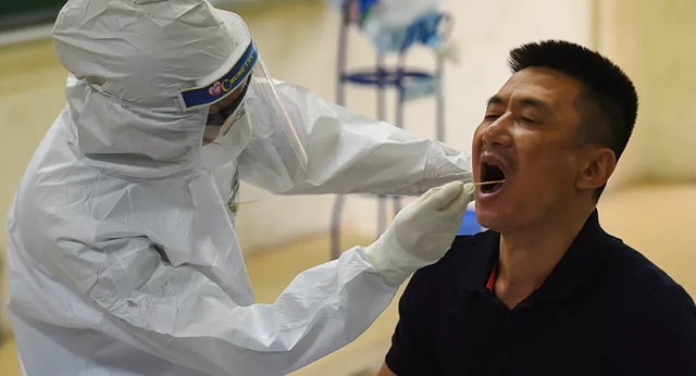 Chuyên gia miễn dịch kể về một trong những bí ẩn của virus SARS-CoV-2 - 1 Chuyên gia miễn dịch kể về một trong những bí ẩn của virus SARS-CoV-2 - 1