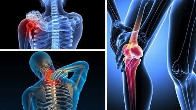 TPBVSK Khang Cốt Đơn - Giải pháp hỗ trợ người mắc bệnh xương khớp - 2 TPBVSK Khang Cốt Đơn - Giải pháp hỗ trợ người mắc bệnh xương khớp - 2