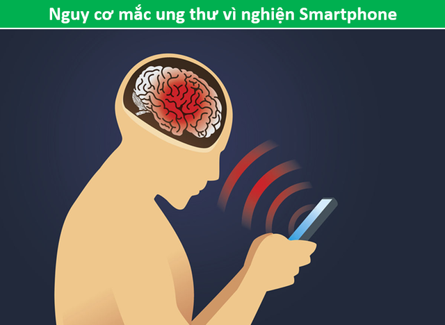 Dùng điện thoại trên 30 phút mỗi ngày làm tăng nguy cơ u não - 1 Dùng điện thoại trên 30 phút mỗi ngày làm tăng nguy cơ u não - 1