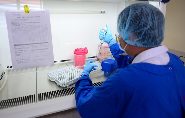 TPHCM: Nguy cơ lây nhiễm ca tái dương tính Covid-19 như thế nào? - 1 TPHCM: Nguy cơ lây nhiễm ca tái dương tính Covid-19 như thế nào? - 1