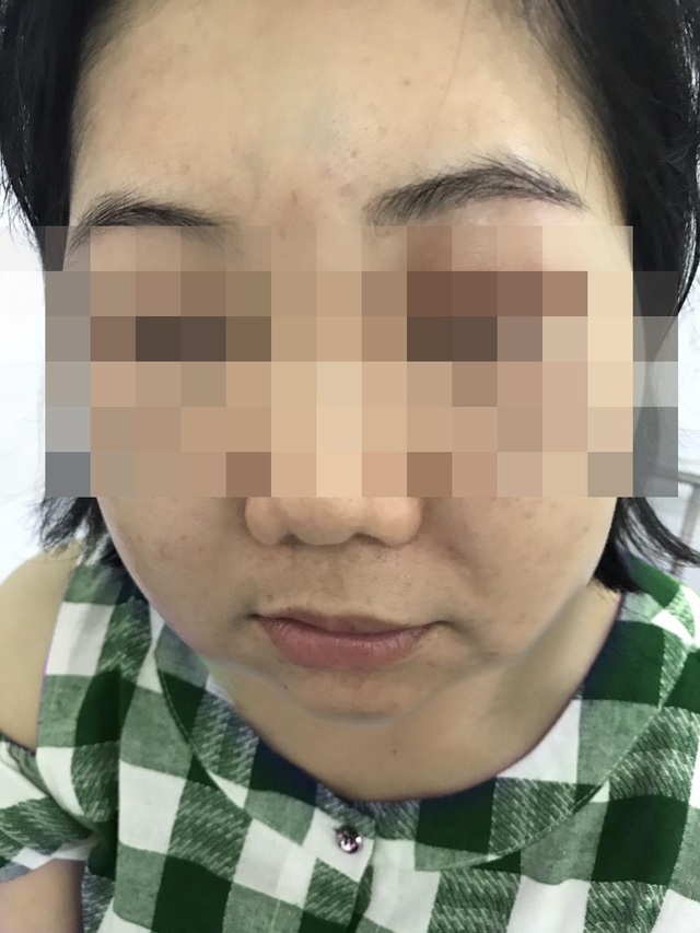 Làm đẹp cấp tốc, nhiều người thành nạn nhân của tế bào gốc - 1 Làm đẹp cấp tốc, nhiều người thành nạn nhân của tế bào gốc - 1