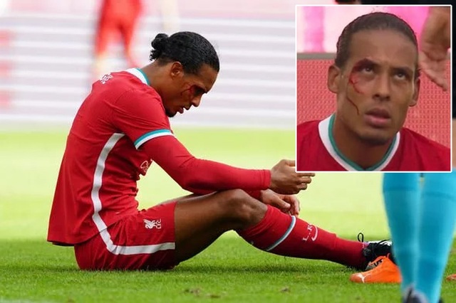 Van Dijk đổ máu trong trận Liverpool may mắn hòa Salzburg - 3