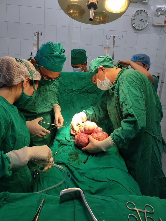 Lấy khối u bằng em bé sơ sinh trong ổ bụng nữ bệnh nhân 83 tuổi - 1