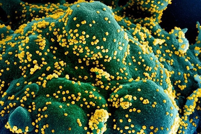 Nhà khoa học Anh cảnh báo mối đe dọa của virus trong tương lai - 1 Nhà khoa học Anh cảnh báo mối đe dọa của virus trong tương lai - 1