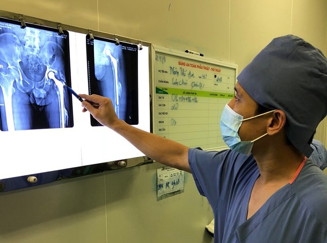 Mổ thay khớp háng 3 lần, bác sĩ phải dùng khớp nhân tạo dài nhất hiện có - 1 Mổ thay khớp háng 3 lần, bác sĩ phải dùng khớp nhân tạo dài nhất hiện có - 1