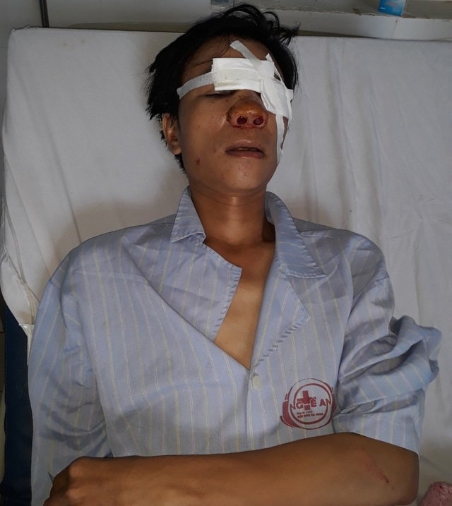 Va chạm giao thông, người đàn ông bị đánh biến dạng mặt, bê bết máu! - 5 Va chạm giao thông, người đàn ông bị đánh biến dạng mặt, bê bết máu! - 5