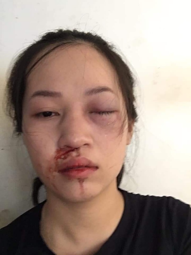 Điều tra thông tin tố cáo CSGT vụt gậy vào mặt người vi phạm - 1 Điều tra thông tin tố cáo CSGT vụt gậy vào mặt người vi phạm - 1