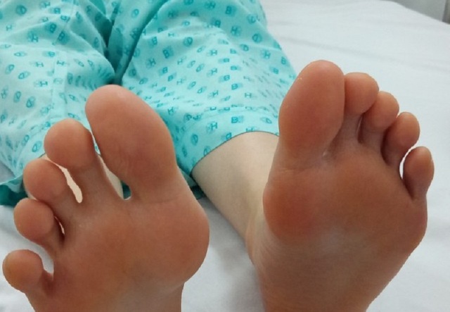 Giải pháp mới giúp điều trị tình trạng đổ mồ hôi chân - 2 Giải pháp mới giúp điều trị tình trạng đổ mồ hôi chân - 2