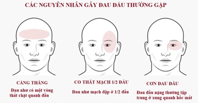 Khi nào đau đầu là dấu hiệu nguy hiểm bạn cần đi khám ngay? - 1 Khi nào đau đầu là dấu hiệu nguy hiểm bạn cần đi khám ngay? - 1