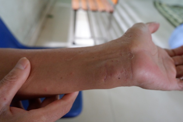 Từ vụ bé 11 tuổi tự sát vì buồn bố mẹ: Quả bom nổ chậm của bệnh trầm cảm - 5 Từ vụ bé 11 tuổi tự sát vì buồn bố mẹ: Quả bom nổ chậm của bệnh trầm cảm - 5