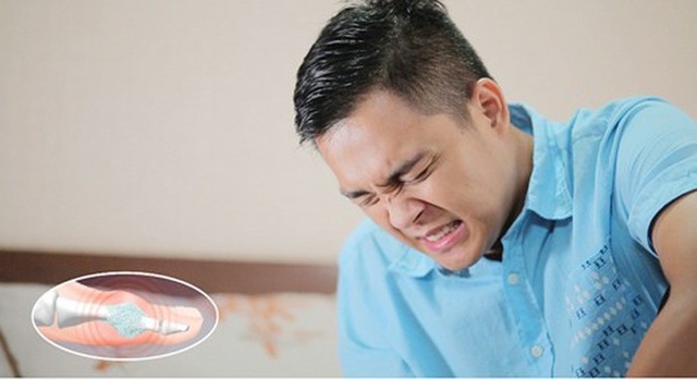 Vì sao bệnh gout đang có dấu hiệu trẻ hóa? - 1 Vì sao bệnh gout đang có dấu hiệu trẻ hóa? - 1