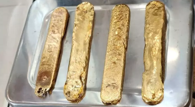 Nhét hơn 1 kg vàng vào hậu môn để lén mang lên máy bay - 1 Nhét hơn 1 kg vàng vào hậu môn để lén mang lên máy bay - 1