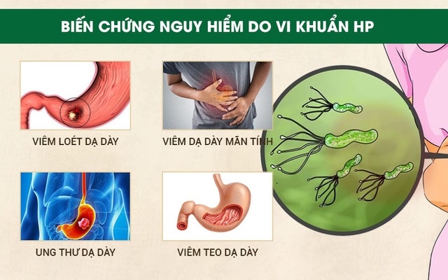 5 điều cần làm để ngừa ung thư dạ dày - 2