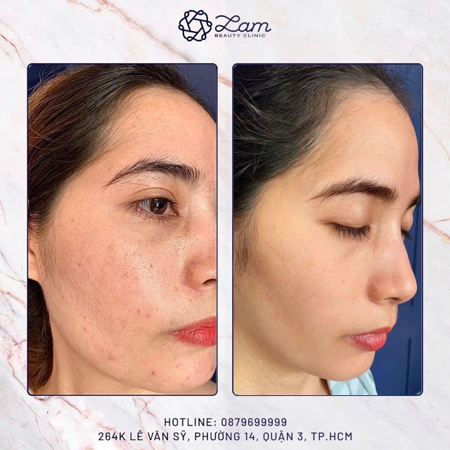 Bí mật của người có làn da đẹp tại Lam Beauty Clinic - 1 Bí mật của người có làn da đẹp tại Lam Beauty Clinic - 1