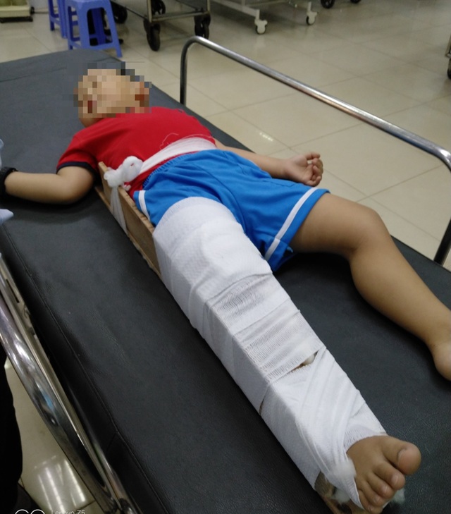 Vụ bé 4 tuổi gãy chân tại trường: Cô giáo quỳ khóc xin lỗi - 2 Vụ bé 4 tuổi gãy chân tại trường: Cô giáo quỳ khóc xin lỗi - 2