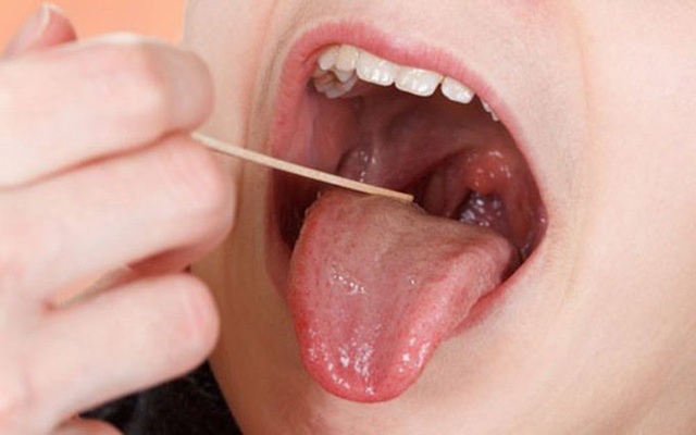 5 bộ phận cơ thể dễ trở thành mục tiêu của ung thư - 5 5 bộ phận cơ thể dễ trở thành mục tiêu của ung thư - 5