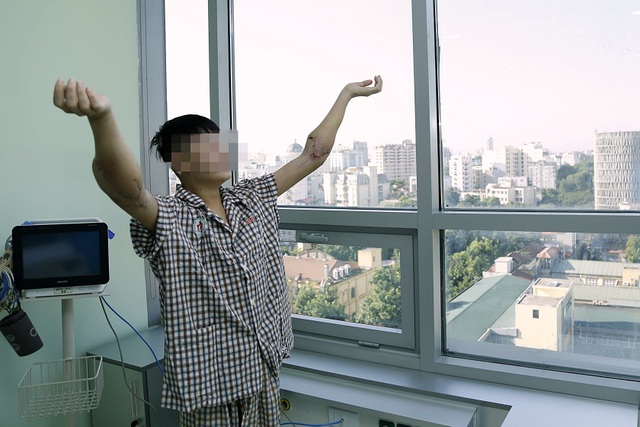 Chàng trai được hồi sinh nhờ 2 cánh tay hiến tặng của người cho chết não - 2 Chàng trai được hồi sinh nhờ 2 cánh tay hiến tặng của người cho chết não - 2