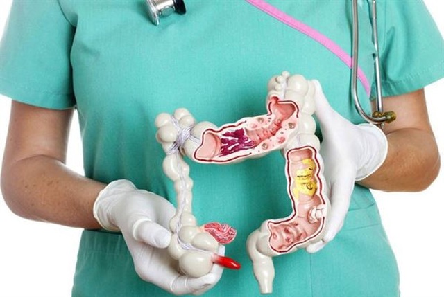 Kéo dài tuổi thọ cho người bị ung thư đại trực tràng tái phát - 1 Kéo dài tuổi thọ cho người bị ung thư đại trực tràng tái phát - 1