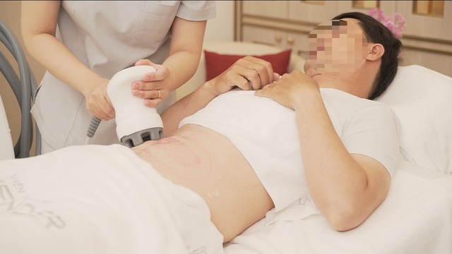 Những người vợ chịu chơi, chi tiền bắt chồng đi xử lý... bụng bia - 1 Những người vợ chịu chơi, chi tiền bắt chồng đi xử lý... bụng bia - 1