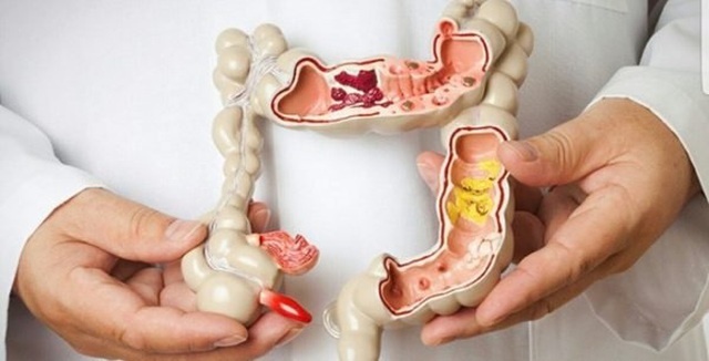 Người trong gia đình mắc ung thư có khiến nguy cơ của bạn tăng lên? - 1 Người trong gia đình mắc ung thư có khiến nguy cơ của bạn tăng lên? - 1